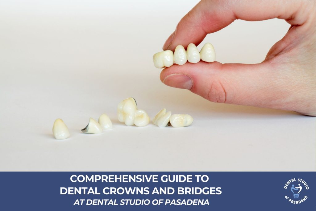 Comprehensive Guide to Dental Crowns and Bridges at Dental Studio of Pasadena New